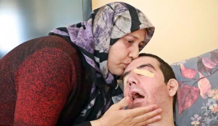 30 yaşındaki Halil, geçirdiği hastalık yüzünden 8 yıldır gözlerini kırpamıyor