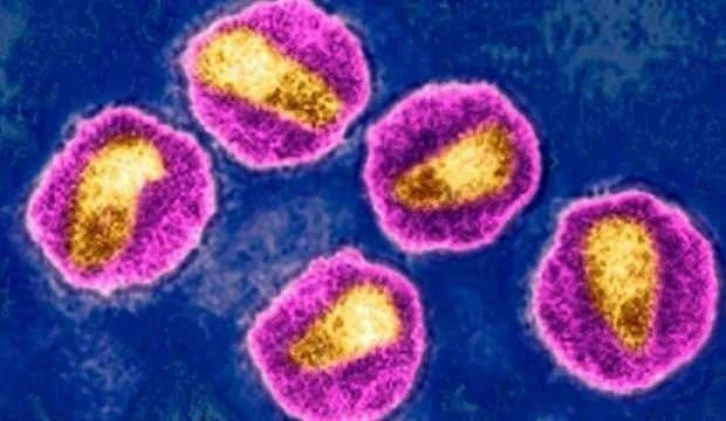 Hollanda’da HIV’in oldukça öldürücü bir varyantı keşfedildi