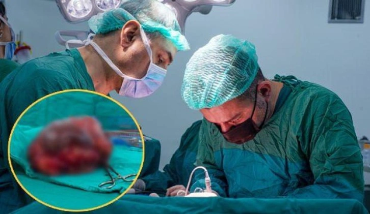 Ülkesinde iyileşemeyen Sudanlı hasta şifayı Türkiye'de buldu! 25 santimlik tümör çıkarıldı
