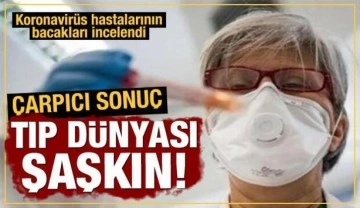 Bilim adamları Koronavirüs hastalarının bacaklarını inceledi: Kan akışı azalmış!