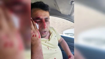 Cizre’de Kaçak Elektrik Kontrolüne Şiddetli Müdahale:  3 Saldırgandan 2’si Tutuklandı
