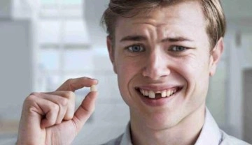 Eksik dişleriniz varsa dikkat! Ağız ve dil kanserine neden oluyor