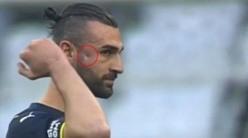 Giresun maçında Fenerbahçeli yıldızın elmacık kemiği çöktü! Apar topar hastaneye kaldırıldı