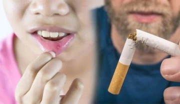 Günde 1 paket sigara içiyorsanız dikkat! Ağız kanseri riski 9 kat fazla