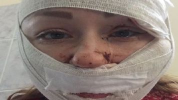 Kadına şiddette yeni perde: Falçata
