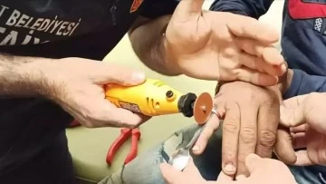 Siirt'te bir gencin parmağına sıkışan yüzüğü itfaiye ekipleri çıkardı