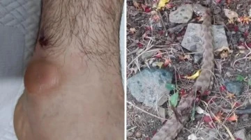 Siirt’te yılanın ısırdığı kişi yoğun bakıma alındı