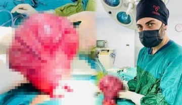 Siirt'te 49 yaşındaki kadın karın ağrısıyla gitti, karnından 4 kiloluk kitle çıkarıldı